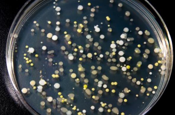 A tray of microbes