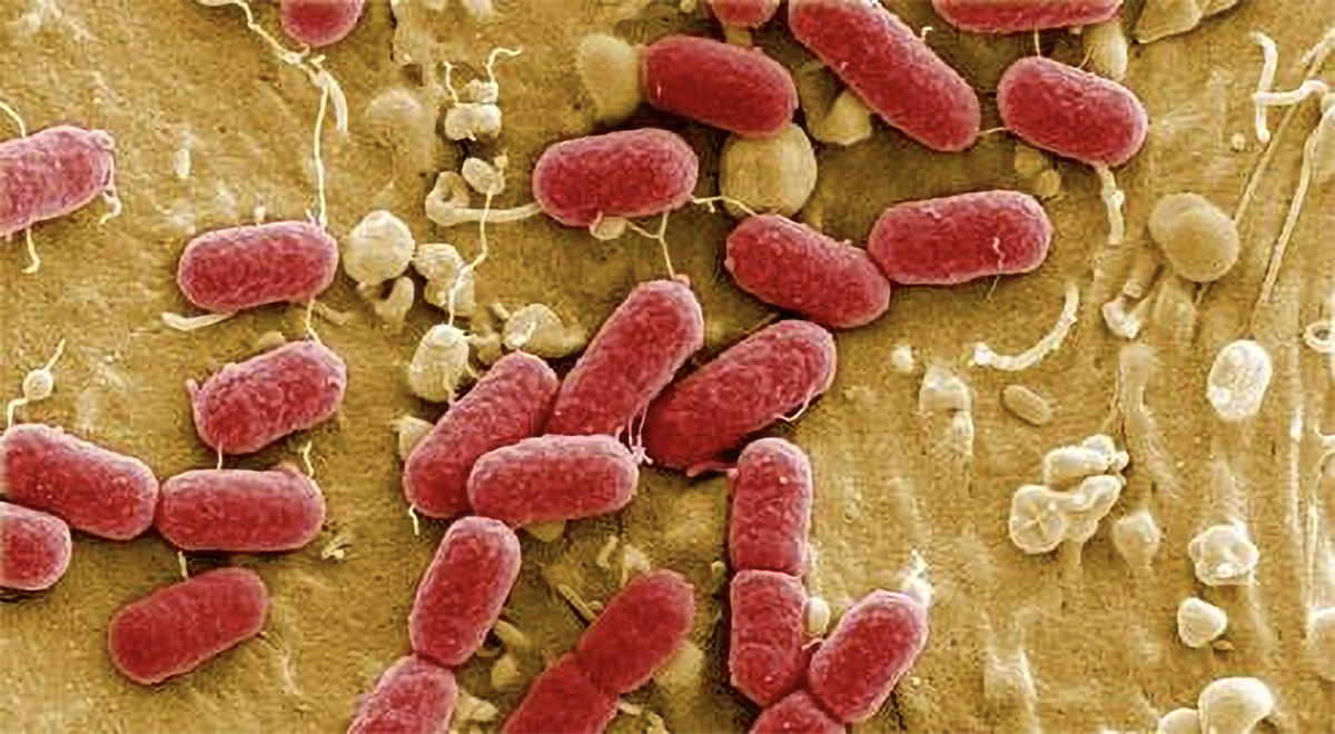coliform bacteria
