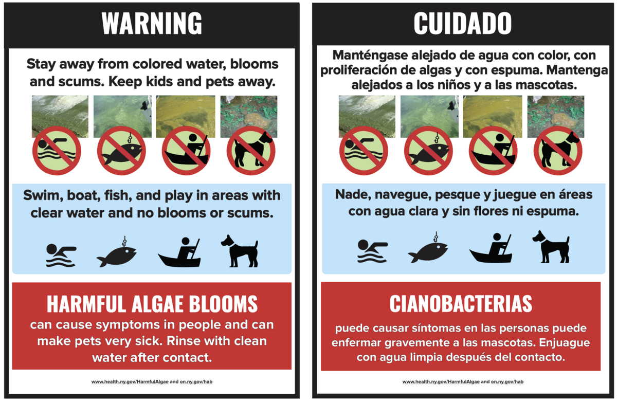 Signs warning of harmful algal blooms